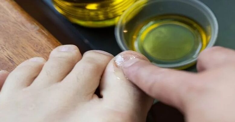Essential oils to fight fungi