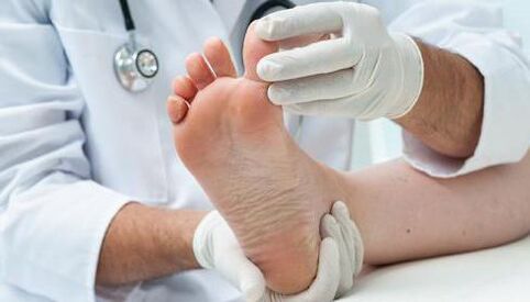 Treatment of fungi