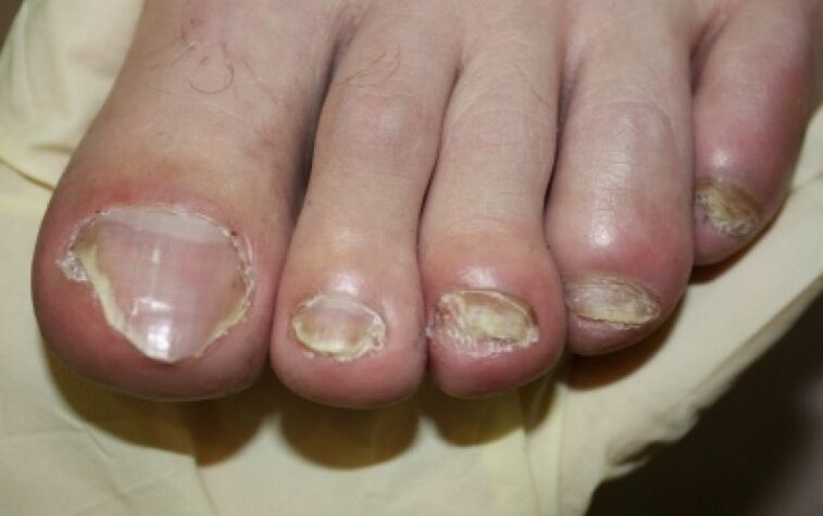 Nails