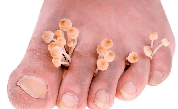 Skin mushrooms