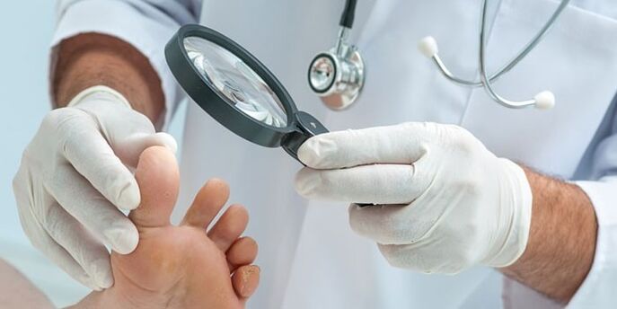 Doctor examined infected leg with a fungus