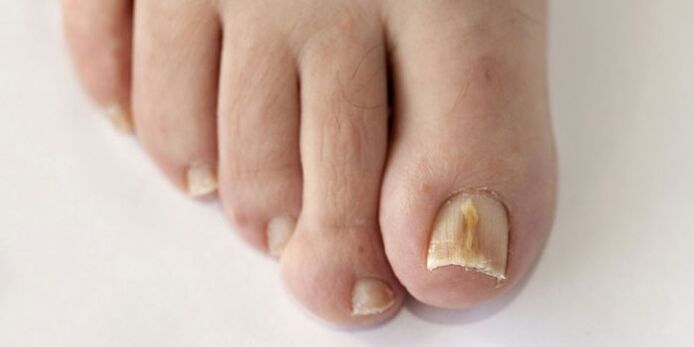 Nails