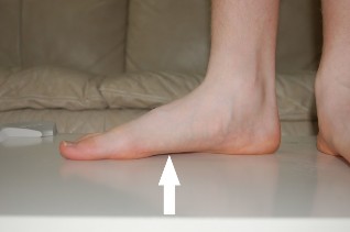 causes flat feet